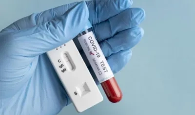 Las pruebas de PCR y de Antígenos siguen realizándose en Colombia.