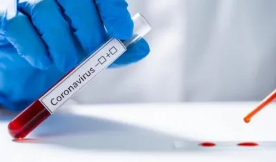 Laboratorios en el país procesaron 35.126 pruebas para detectar el Covid-19.