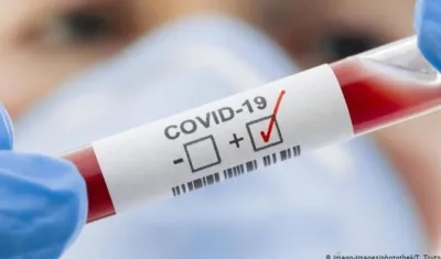 Los laboratorios procesaron  56.621 para detectar el Covid-19.