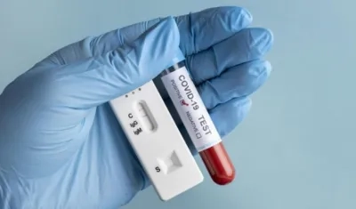 Los laboratorios del país procesaron 55.507 pruebas para detectar el coronavirus.