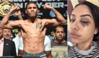 Juan Manuel López y Andrea Ojeda, luego de la supuesta agresión. 