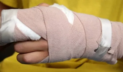 Quemado con pólvora.