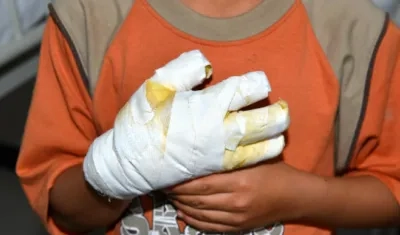 Hay varios casos de amputación y daños oculares por manipular pólvora.