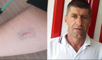 Concejal de Marulanda Alfredo Morales Llano atacó a patrullera, propinándole un mordisco.