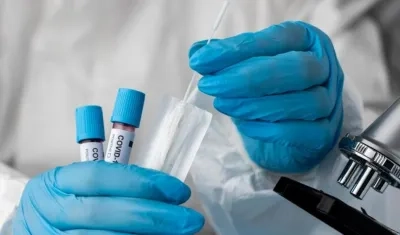 Imagen de prueba de Covid-19.