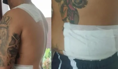 Zona donde fue apuñalado el hombre por los ladrones. 