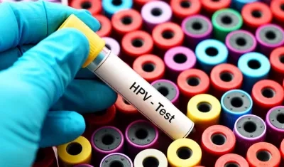 Existen más de 200 tipos de VPH, aunque solo un pequeño grupo de ellos es de alto riesgo.