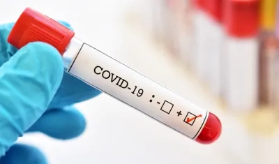 El Covid-19 sigue aún en Colombia.