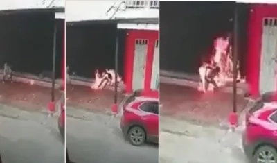 Este hombre fue quemado mientras dormía.