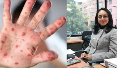 Claudia Cuéllar, directora de Epidemiología del Ministerio de Salud, explicó lo que se sabe de este virus.