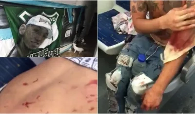 El robo de la bandera dejó estos heridos. 