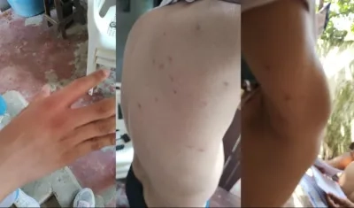 Estudiantes atacados por abejas africanizadas. 