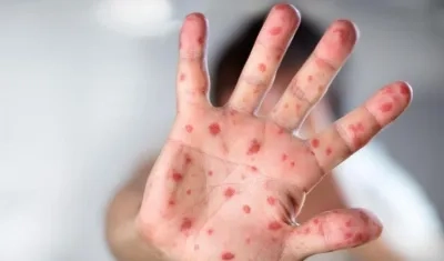 Imagen de referencia.