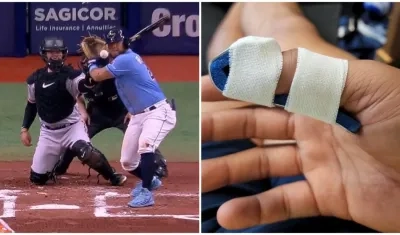 Pelotazo a Harold Ramírez. 