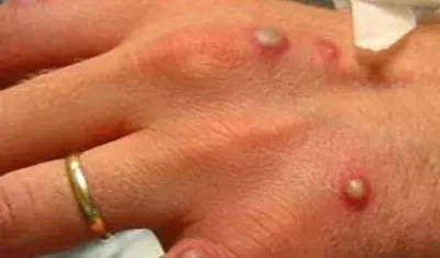 Imagen de referencia.