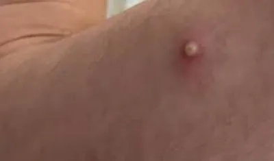 Imagen de referencia.