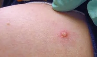 Imagen de referencia.