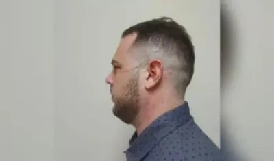 John Poulos presenta marcas de rasguños en su cara y cuello.