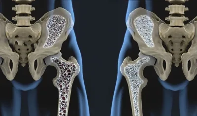 Imagen de referencia.