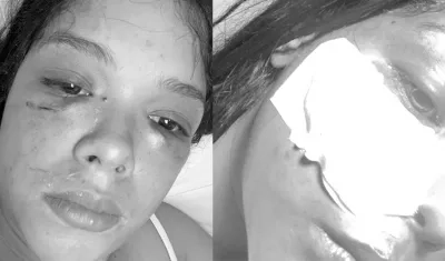 Así quedó la mujer tras la violenta agresión de su pareja. 