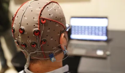 Imagen de archivo de un tratamiento cerebral