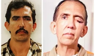 Tras su cáncer de ojo la apariencia de Luis Garavito cambió notablemente. 