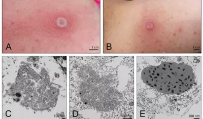 Imágenes referenciales del virus Alaska.