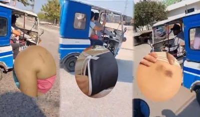 Una de las pasajeras tuvo que recibir atención médica por sus heridas. 