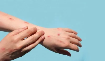 Imagen de referencia.