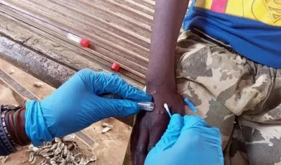 Viruela del mono está azotando África.