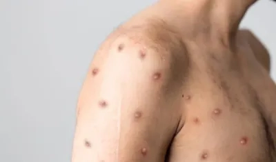 Imagen de referencia.