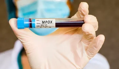 Prueba de sangre para detectar Mpox.