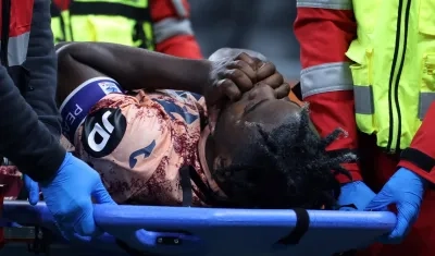 Duván Zapata es retirado en camilla tras lesionarse en el partido contra el Inter de Milán. 