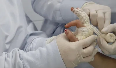 Cinco lesionados con pólvora en Barranquilla. Imagen de referencia