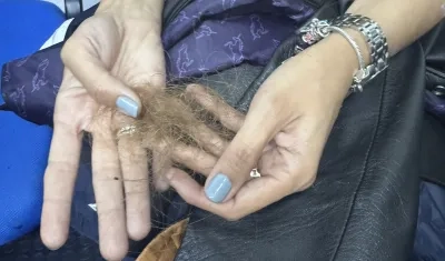 Resultaron con quemaduras en la piel, las manos y el cabello. 