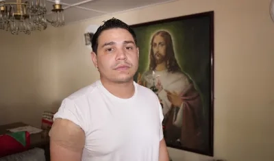 El artista guajiro muestra donde resultó herido en su brazo derecho. 