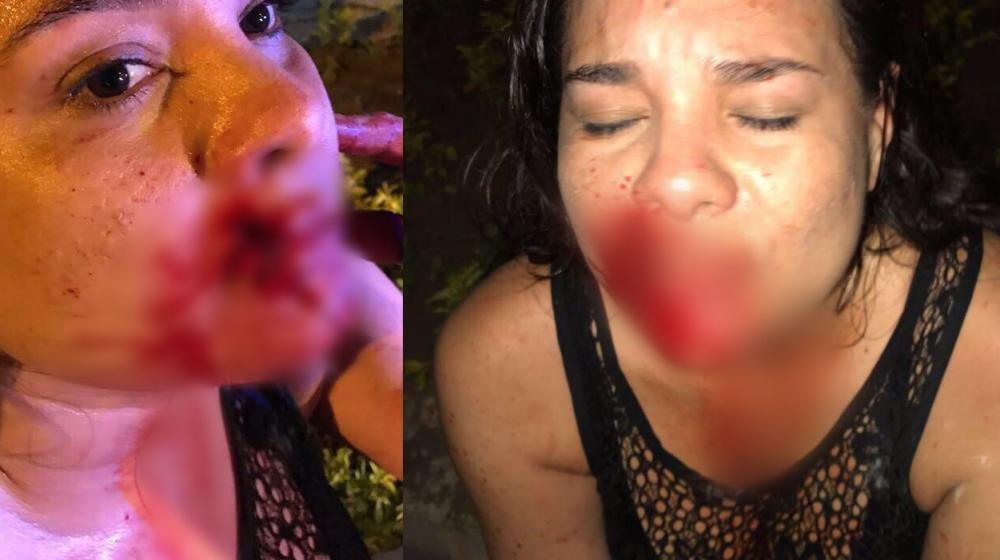 Así quedó el rostro de una de las mujeres.