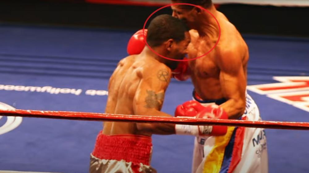 Momento del cabezazo de Kendal Holt a Ricardo ‘Mochuelo’ Torres.