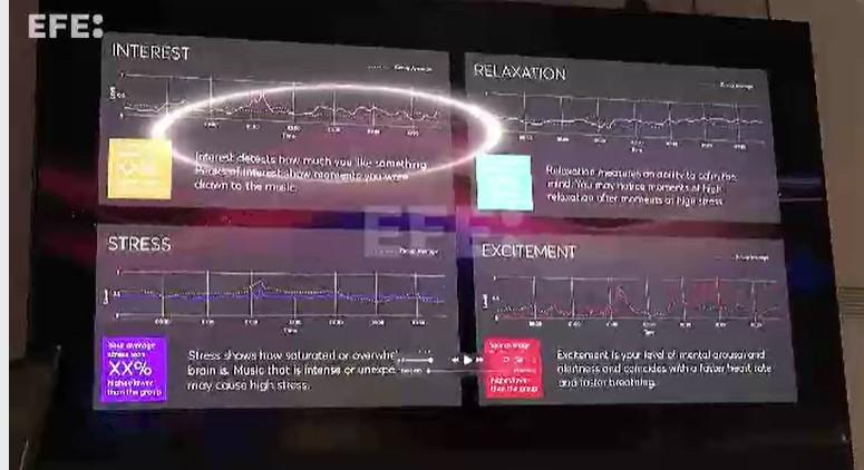 Diferentes estados del cerebro a medida que se escucha a Pink Floyd